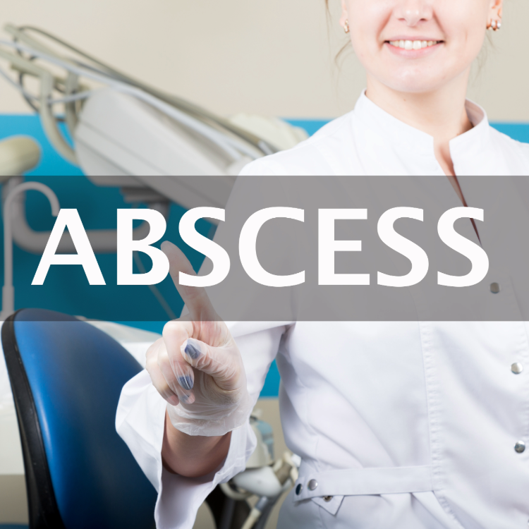 Dental Abscess